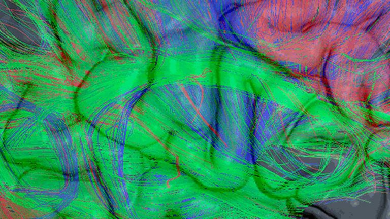 Cognitive Neuroscience