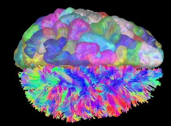 Brain image