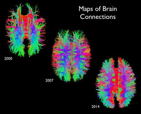 Improvements in MRI and software tools have led to unprecedented opportunities to map the connections between different brain regions. In this case, the different colors correspond to the primary orientation of the pathways (up-down=blue, left-right=red, front-back=green). Brain Imaging