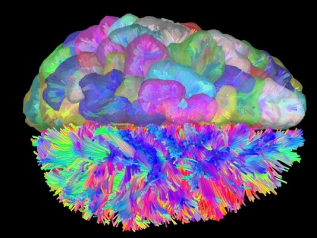 Brain image