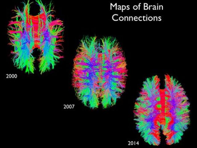 Brain Imaging